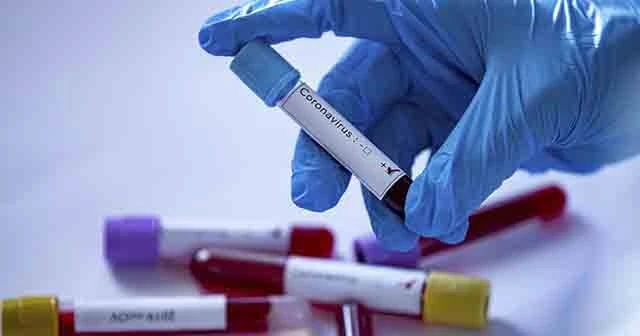 Londra’da yeni doğan bebeğe Korona virüs teşhisi kondu