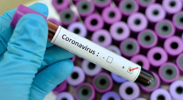 Ruanda ve Esvatini&#039;de ilk koronavirüs vakaları görüldü