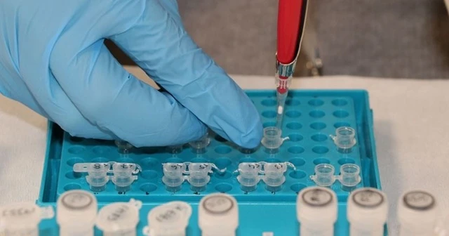 ABD'de yürütülen çalışma kan testiyle kanserin daha erken teşhis edilebileceğini gösterdi