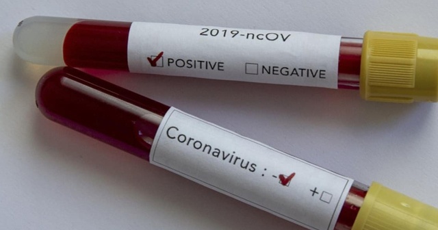 Dünya genelinde koronavirüs bulaşan kişi sayısı 1 milyon 349 bini aştı