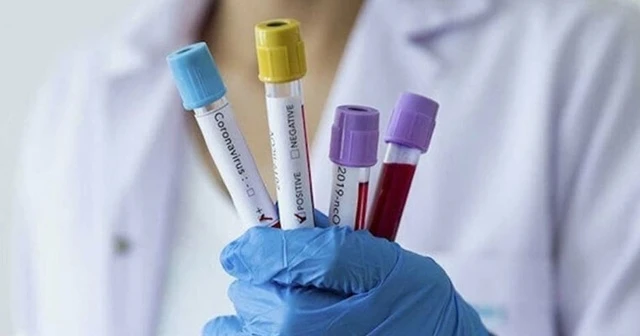 Rusya'da korona virüsten ölenlerin sayısı 24'e yükseldi