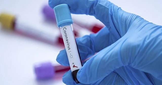 Çin'in Vuhan kentinde 6,5 milyondan fazla kişiye test yapıldı