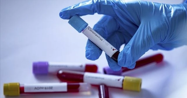 Koronayı yenen ünlü profesör kalbine yenik düştü