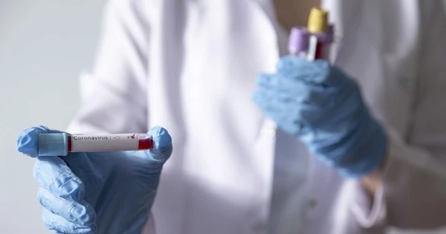 Kovid-19'dan iyileşenlerin sayısı dünya genelinde 2,5 milyonu aştı