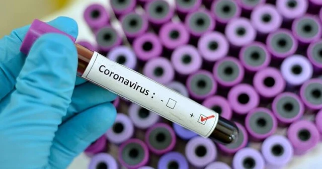 Sudan’da Covid-19 vaka sayısı 4 bine yaklaştı