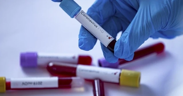 Üçlü antiviral kombinasyonu yeni tip koronavirüs tedavisinde iyileşmeyi hızlandırdı