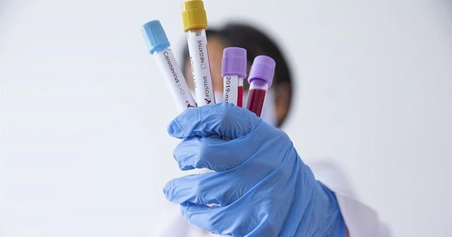 Afrika'da en fazla Kovid-19 testi Güney Afrika Cumhuriyeti'nde yapıldı