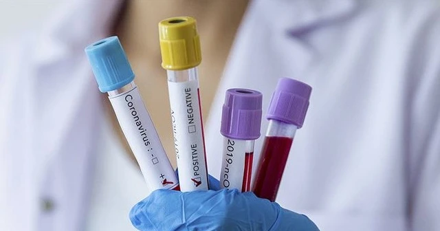 Başbakan ülkesinin koronavirüse galip geldiğini ilan etti