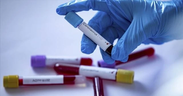 Dünya genelinde Kovid-19 tespit edilen kişi sayısı 8 milyon 776 bini geçti