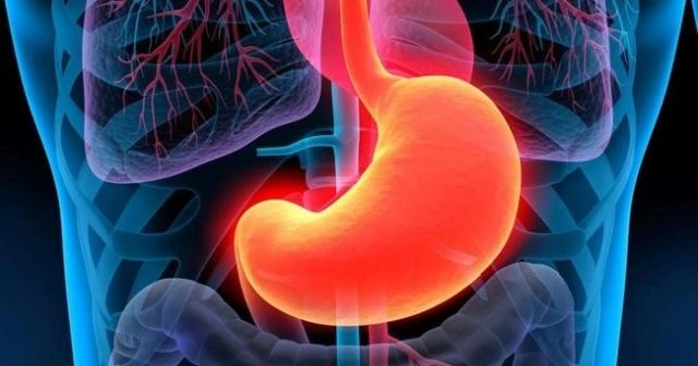 Gastrit nedir? Gastritin Belirtileri Nelerdir Ve Tedavisi Var Mıdır Gastrite Ne İyi Gelir