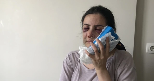 Kartal’da dehşeti yaşayan 2 çocuk annesi: Benim evet diyebildiğim kadar hayır deme hakkım yok