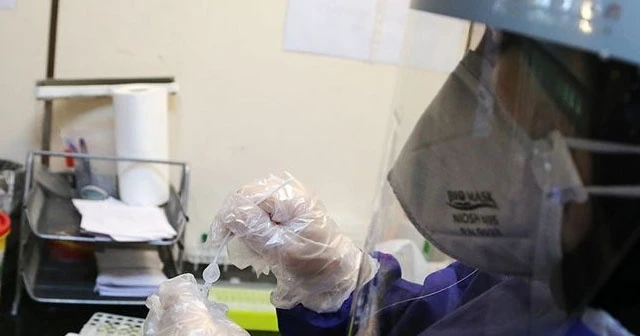 Dünya genelinde Kovid-19 tespit edilen kişi sayısı 13 milyon 976 bini geçti