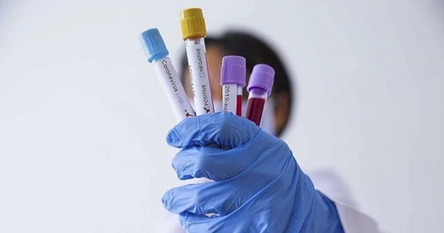 Singapur'da yeni bir Kovid-19 test kiti geliştirildi