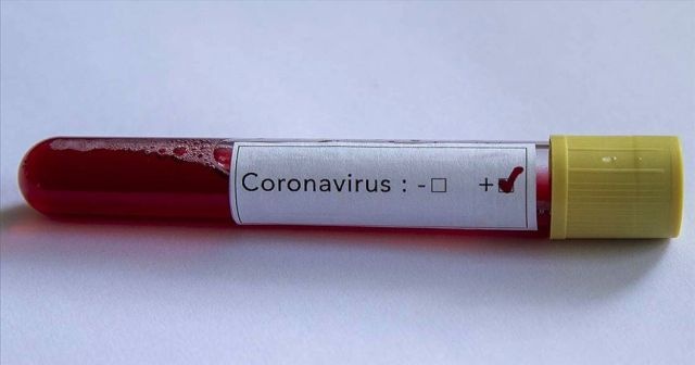 MotoGP&#039;de bir kişide koronavirüs tespit edildi