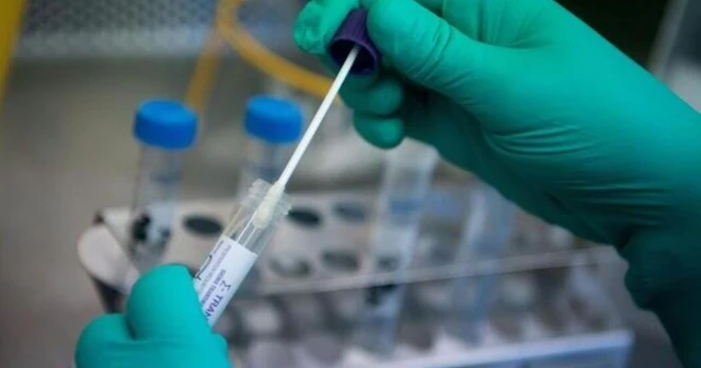 Yurt dışına çıkacaklar PCR testi için 110 lira ödeyecek