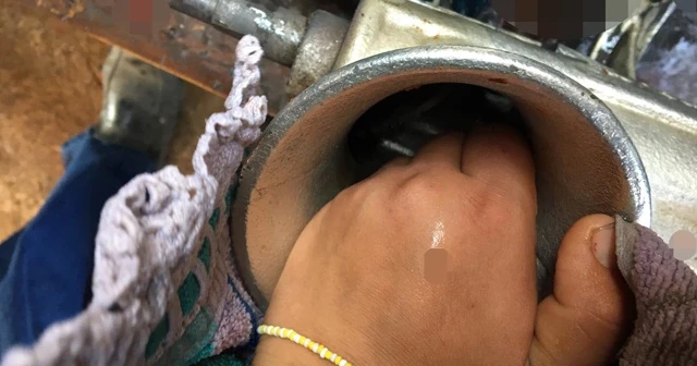 Elini kıyma makinesine kaptıran genç kızın yardımına itfaiye ekipleri yetişti