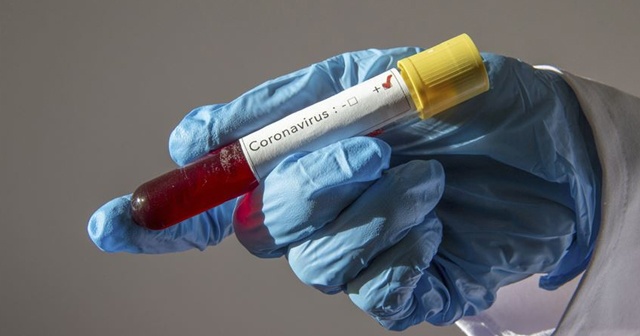 West Ham United&#039;da 3 kişinin koronavirüs testi pozitif çıktı