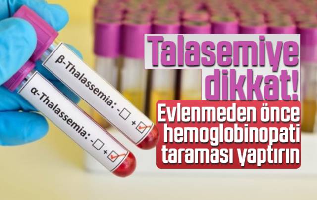 Evlilik Öncesi Hemoglobinopati Nedir? Orak Hücreli Anemi Nedir?