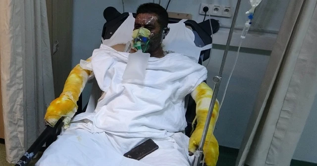Ailesini yanmaktan kurtardı, kendisi hastanelik oldu