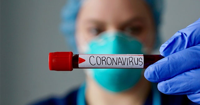 Azerbaycan&#039;da son 24 saatte 4 bin 170 yeni korona virüs vakası tespit edildi