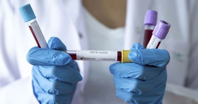 Covid-19 salgınında ölüm oranı en yüksek yer açıklandı