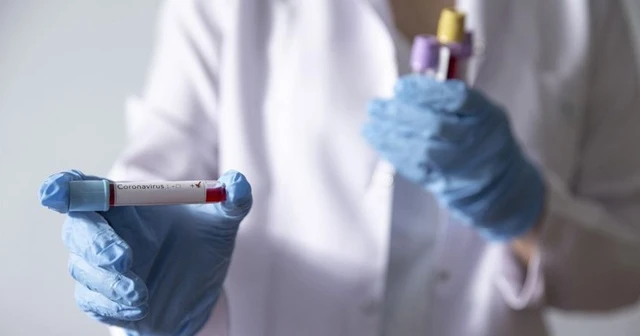 Kasımpaşa'da 7 oyuncu yeni tip koronavirüse yakalandı