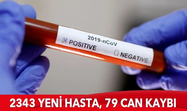 Türkiye’de koronavirüste son durum: 2343 yeni hasta, 79 can kaybı