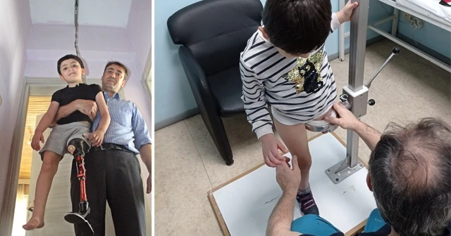 “Baba koşabilecek miyim?” diye sordu, yeni protezine kavuştu