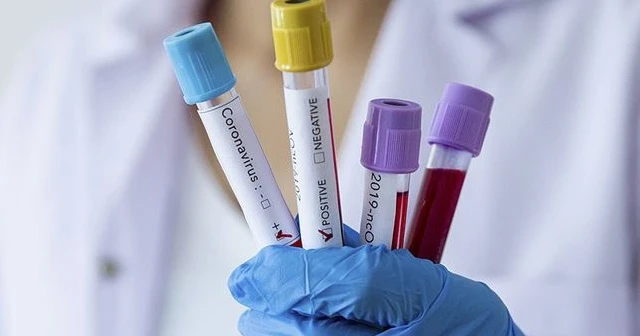 D vitamininin Kovid-19'u önlemede etkisine yönelik yeterli kanıt yok