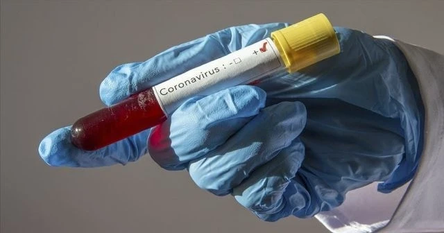 Kalp ve Damar Cerrahı Profesör Covid-19’a yenik düştü