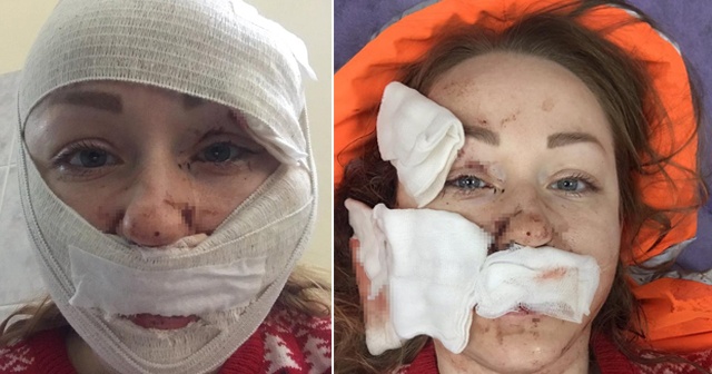Falçatalı saldırıya uğrayan kadından sosyal medyada yardım çığlığı