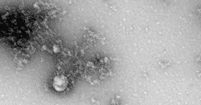 Koronavirüs mutasyonunun fotoğrafı çekildi