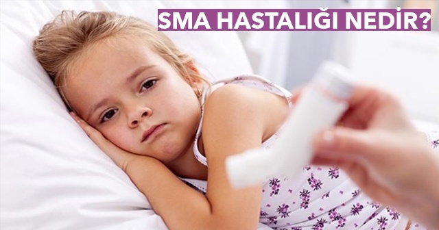 SMA hastalığı nedir? SMA hastalığı belirtileri nelerdir? Spinal Musküler Atrofi hastalığının tedavisi nedir?