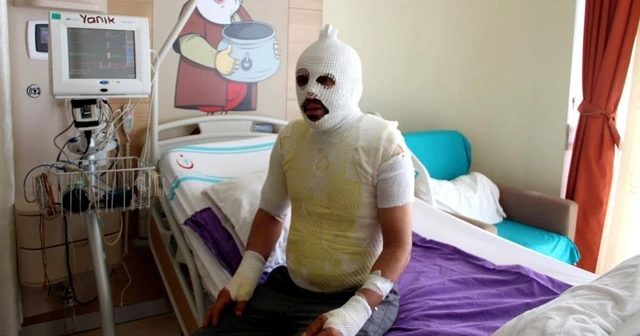 Akrabaları tarafından kaynar suyla yakıldığını iddia etti