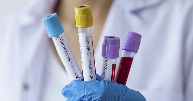 Mantı gününe katılan kadının Kovid-19 testi pozitif çıkınca 8 daire karantinaya alındı