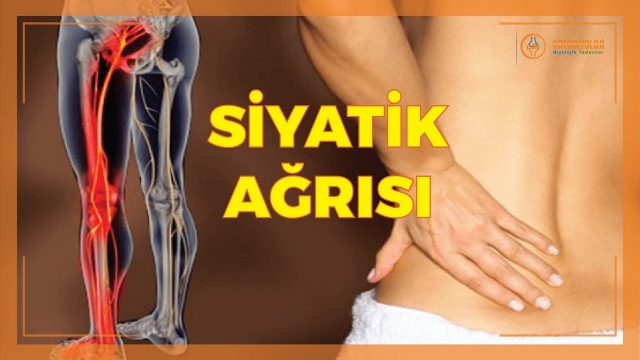 Siyatik ağrısı nedir? Siyatik hastalığı nasıl tedavi edilir?