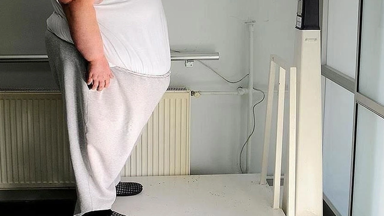 Obezite ameliyatlarına kriterler geliyor