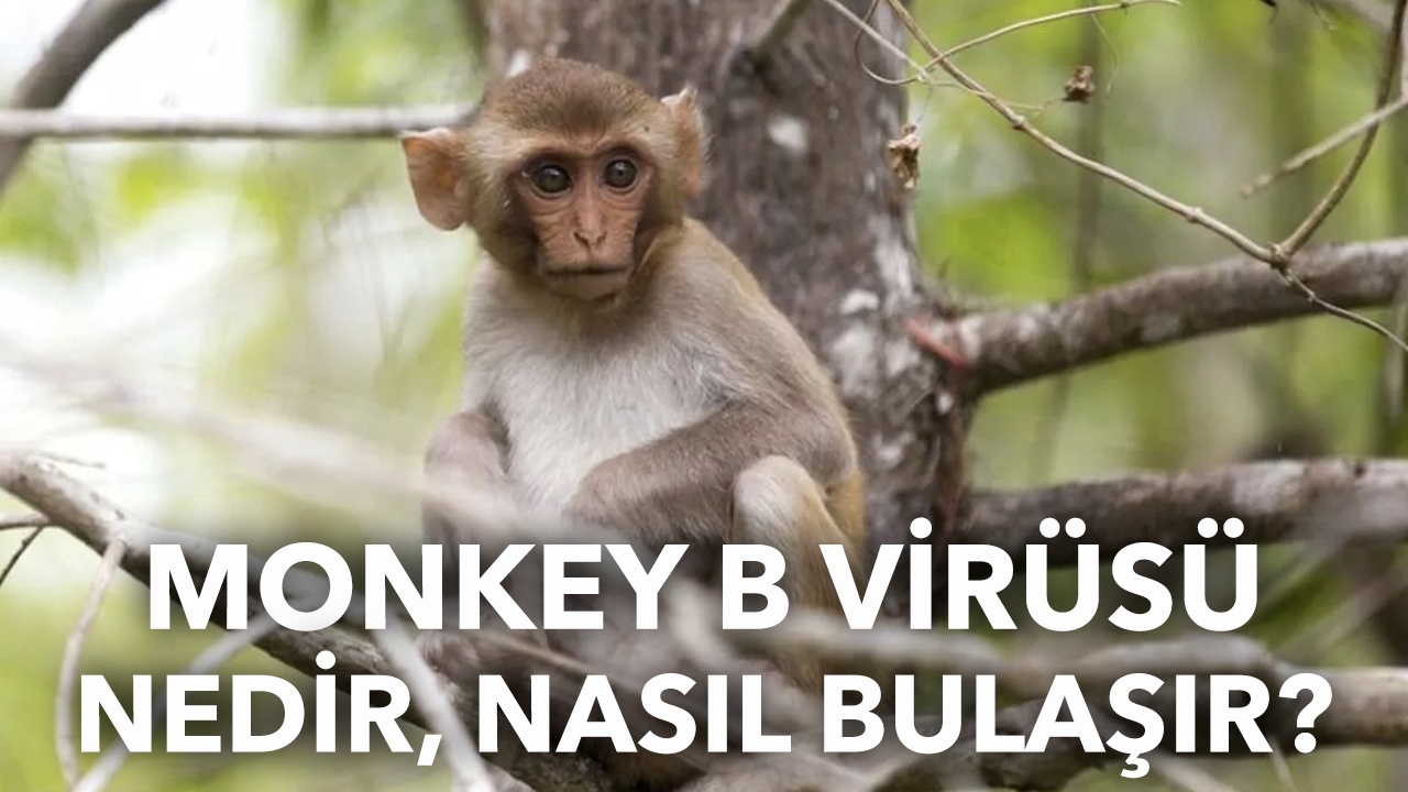 Monkey B virüsü nedir? Monkey B virüsü nasıl bulaşır?