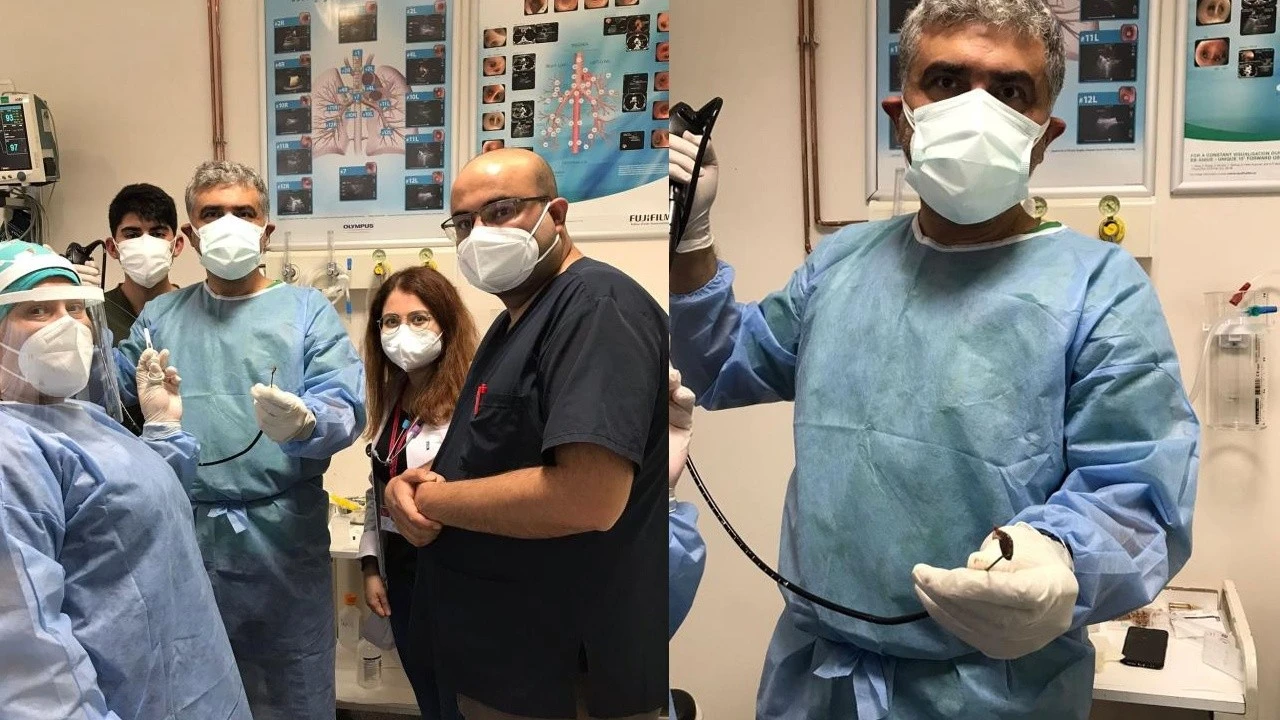 Doktorları şaşkına çevirdi: Akciğerinden çekirdek çıktı