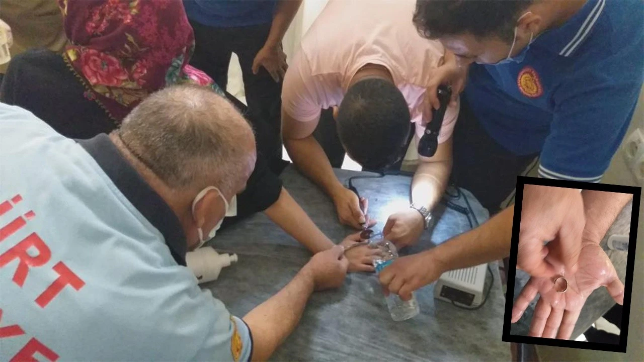 Parmağına sıkışan yüzükten itfaiyenin 1 saatlik çalışmasıyla kurtuldu
