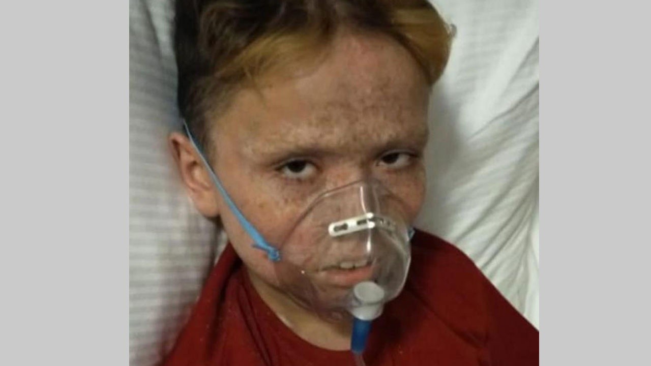 Lösemi tedavisi gören 13 yaşındaki Ensar&#039;dan acı haber