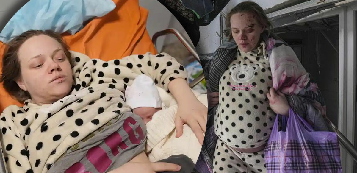 Doğum hastanesine düşen bombalardan kurtulan Ukraynalı kadın doğum yaptı