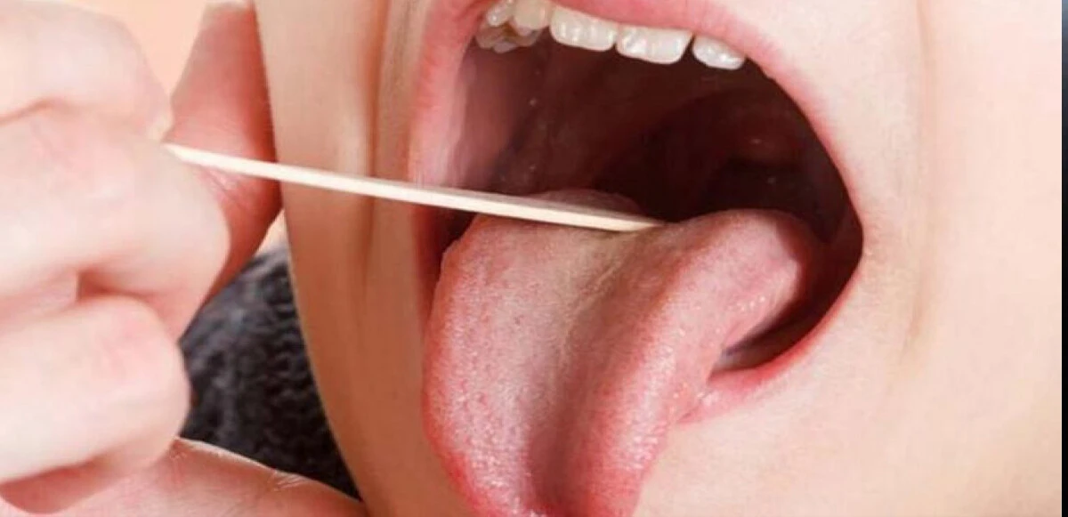 Dilinize bakın hastalığınızı anlayın!