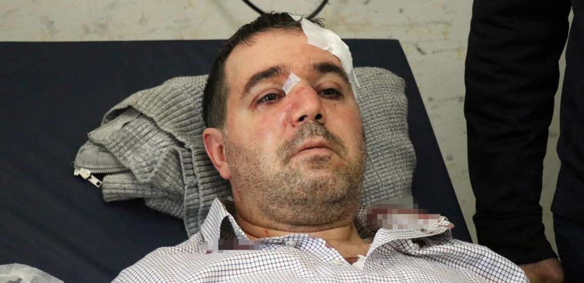 Sağlık çalışanlarına şiddet son bulmuyor: Taciz iddiasıyla aile hekiminin burnunu kırdı