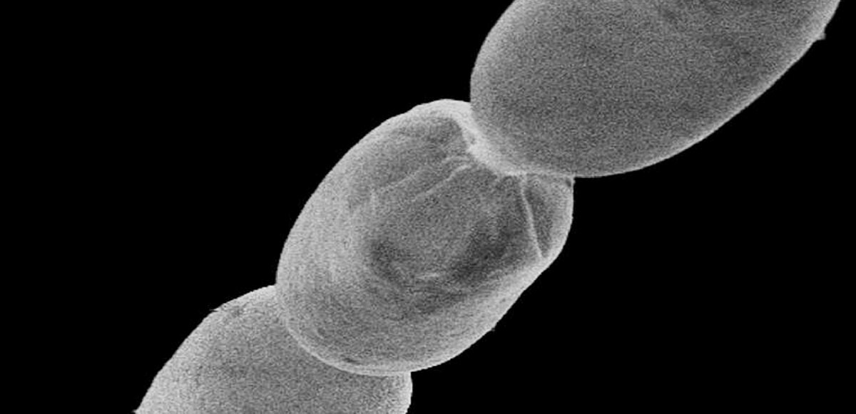Dünyanın en büyük bakterisi keşfedildi, gözle görülüyor