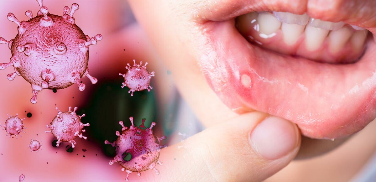 Koronavirüsün yeni belirtisi için uzmanlar uyardı: Ağzın içine dikkat, hastalığın seyrini değiştirebilir