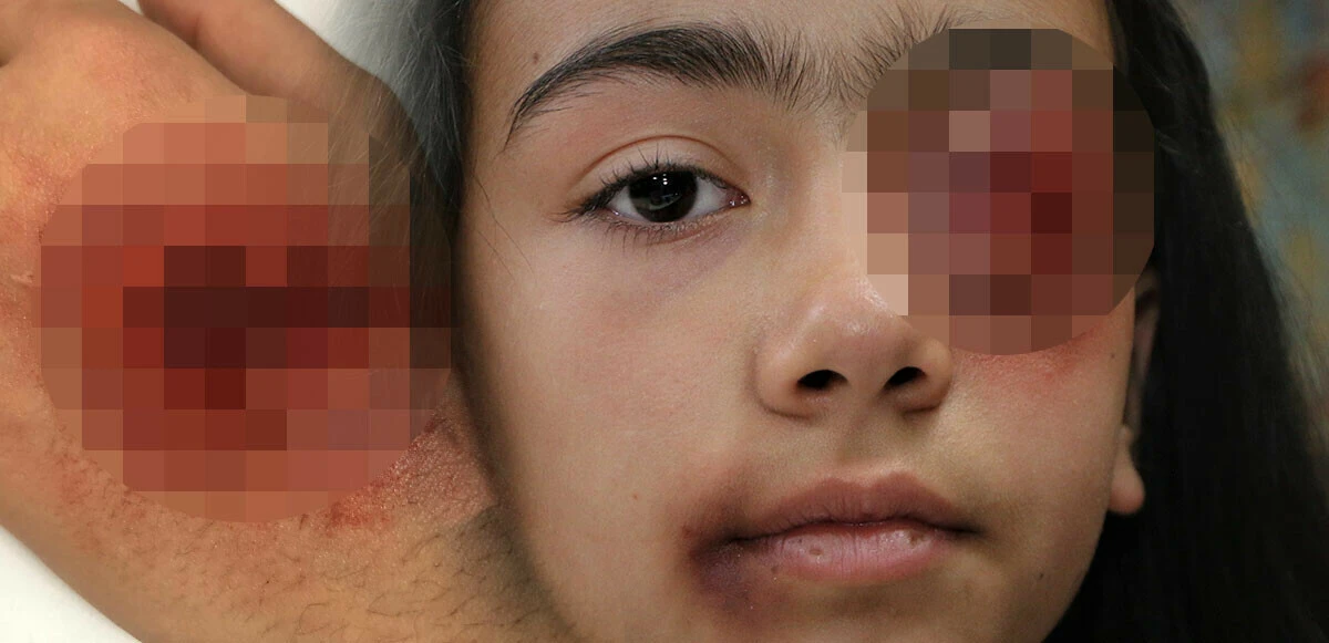 Patlamış göz, kesilmiş el ve ayak…13 yaşındaki çocuğun yaptığı şaşkına çevirdi