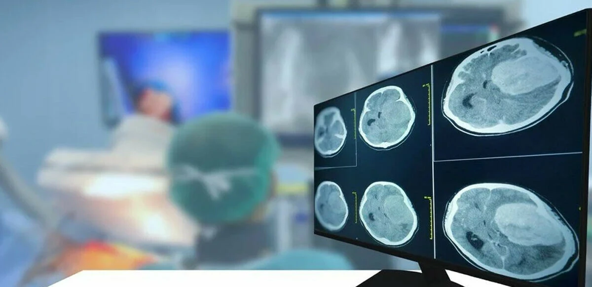 Amansız hastalığa çare olabilir! Geliştirilen 'implant' tümörü 15 günde yok ediyor