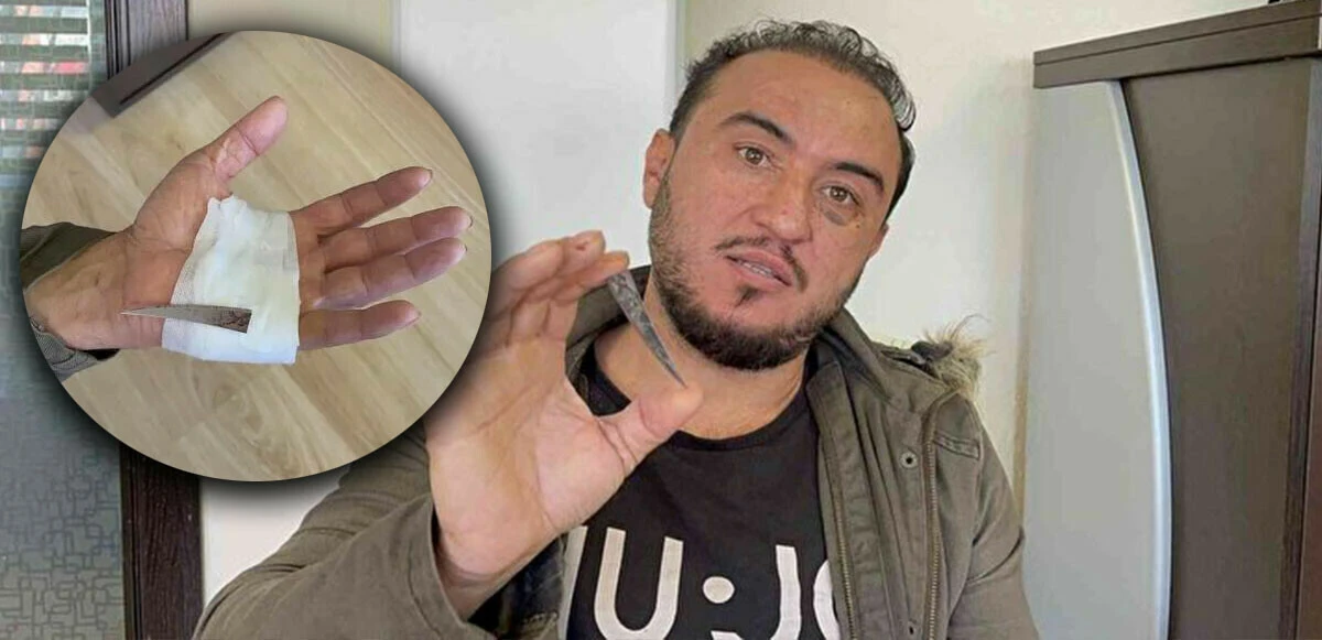 Hayati gerçek çektirdiği röntgenle ortaya çıktı... Eline giren bıçakla 2 ay yaşamış