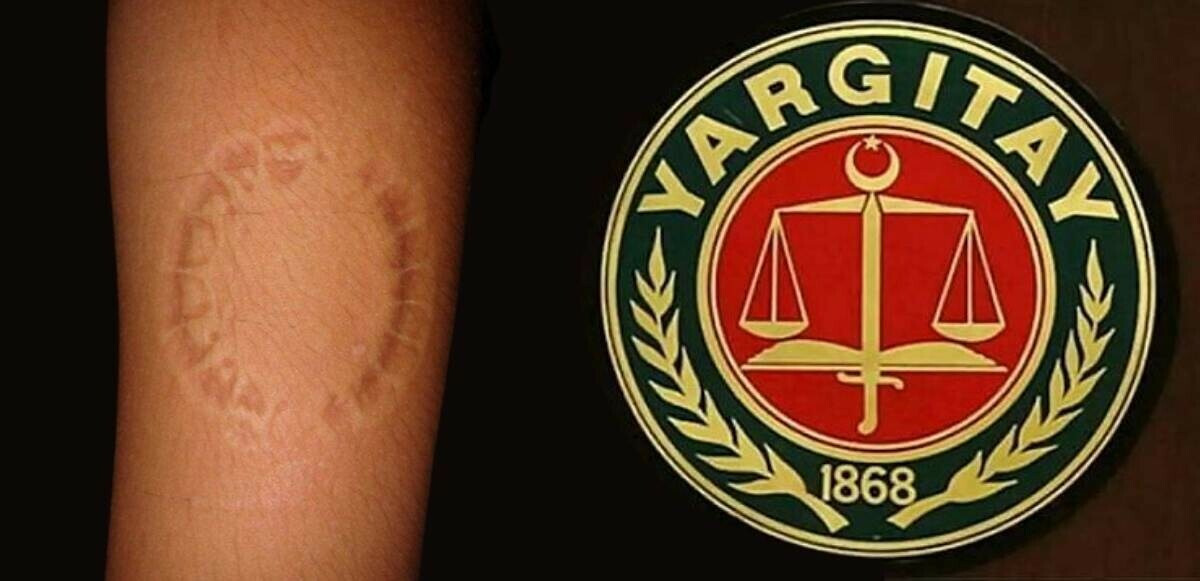 İş arkadaşını ısıran çalışana Yargıtay&#039;dan kötü haber: Tazminatsız kovulma haklı bulundu